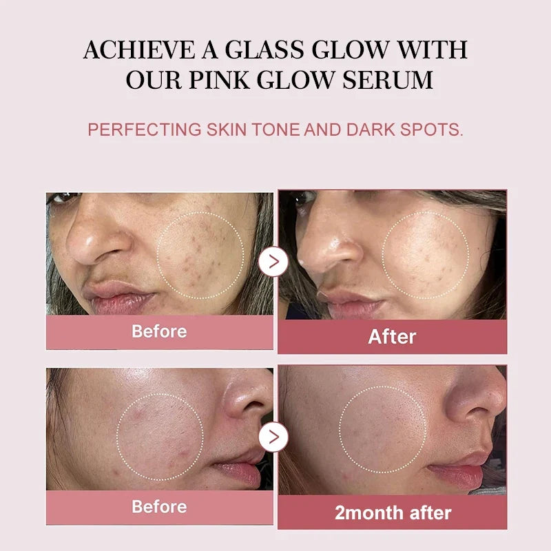 Sérum facial de péptidos de colágeno y PDRN de salmón para piel apagada - Aumenta la elasticidad, renovación y reparación de la piel, producto de belleza coreano