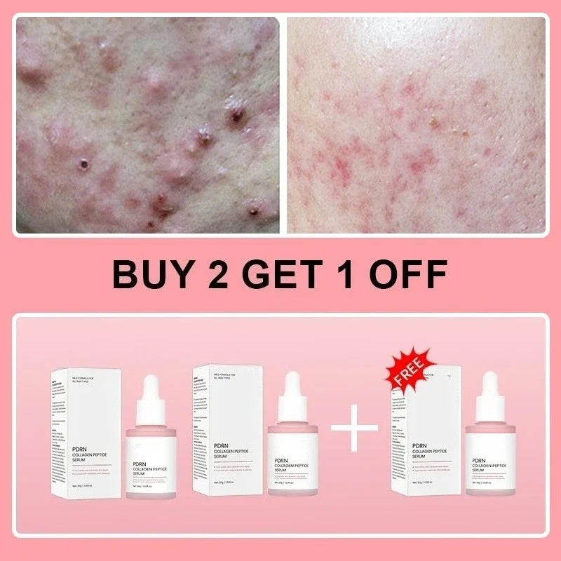 Sérum facial de péptidos de colágeno y PDRN de salmón para piel apagada - Aumenta la elasticidad, renovación y reparación de la piel, producto de belleza coreano