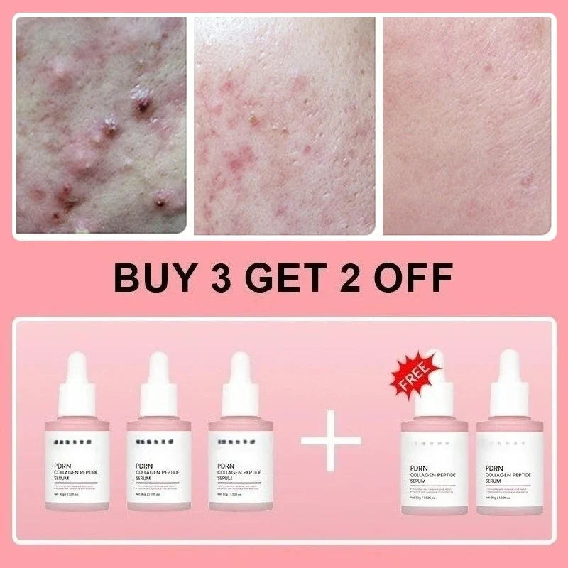 Sérum facial de péptidos de colágeno y PDRN de salmón para piel apagada - Aumenta la elasticidad, renovación y reparación de la piel, producto de belleza coreano
