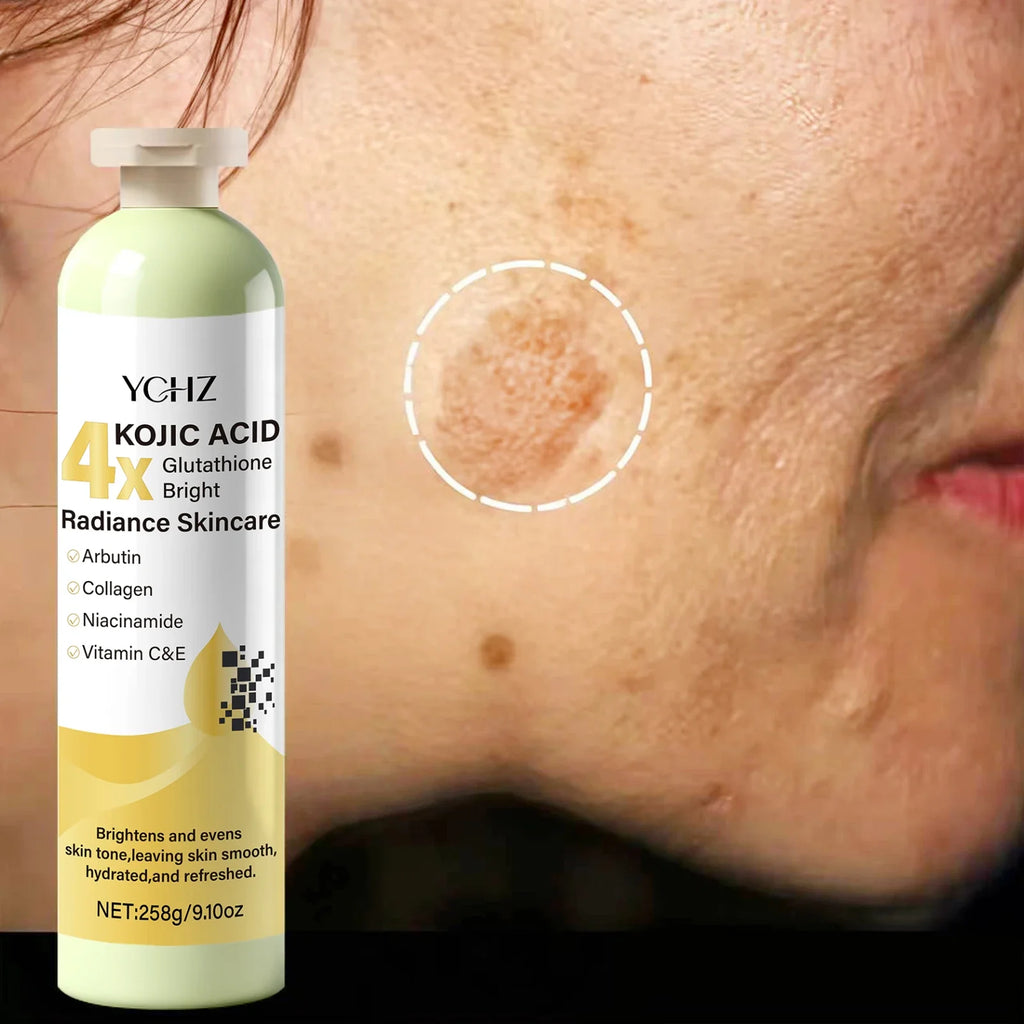 Kojic Acid Cream, Evens Out Skin Tone, Eliminates Dark Spots and Dullness - Non-Greasy, Suitable for Both Men and Women - Whitening and Moisturizing Cream, for Day and Night Use - 258g